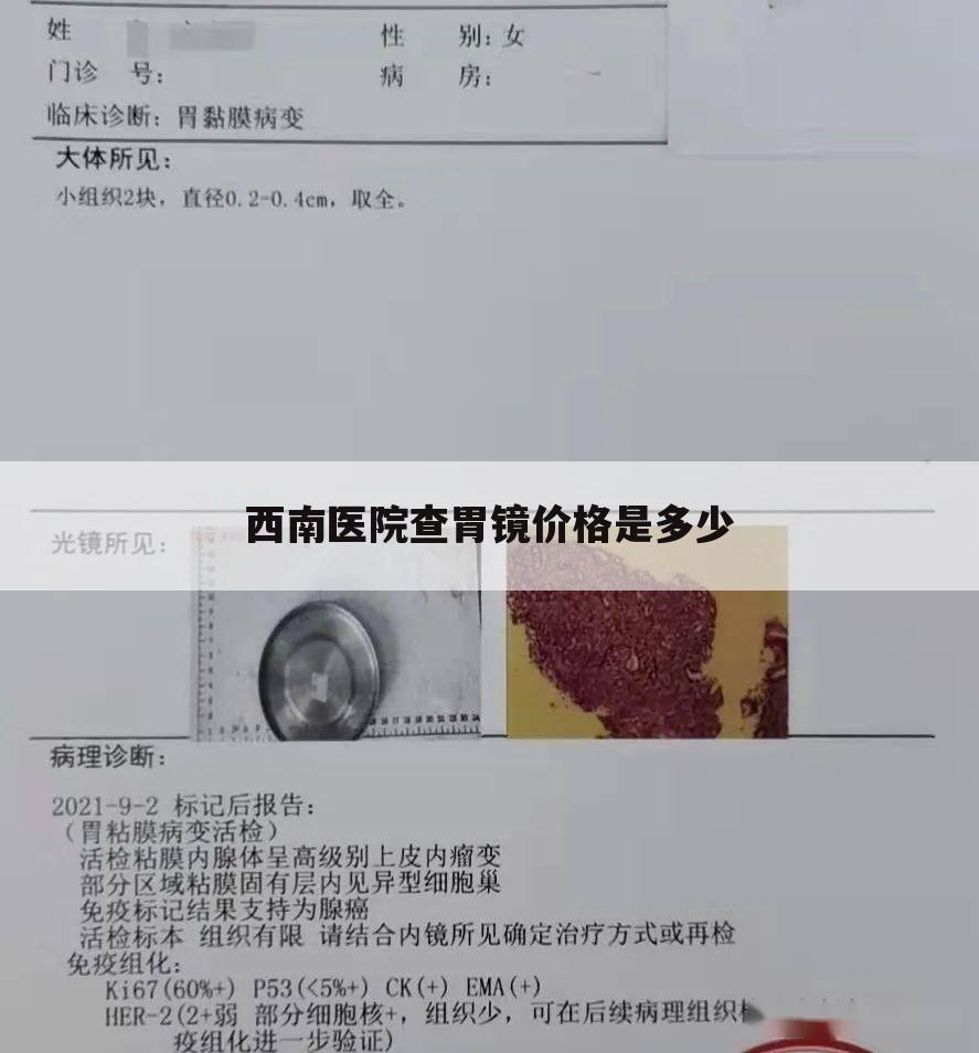 西南医院查胃镜价格是多少