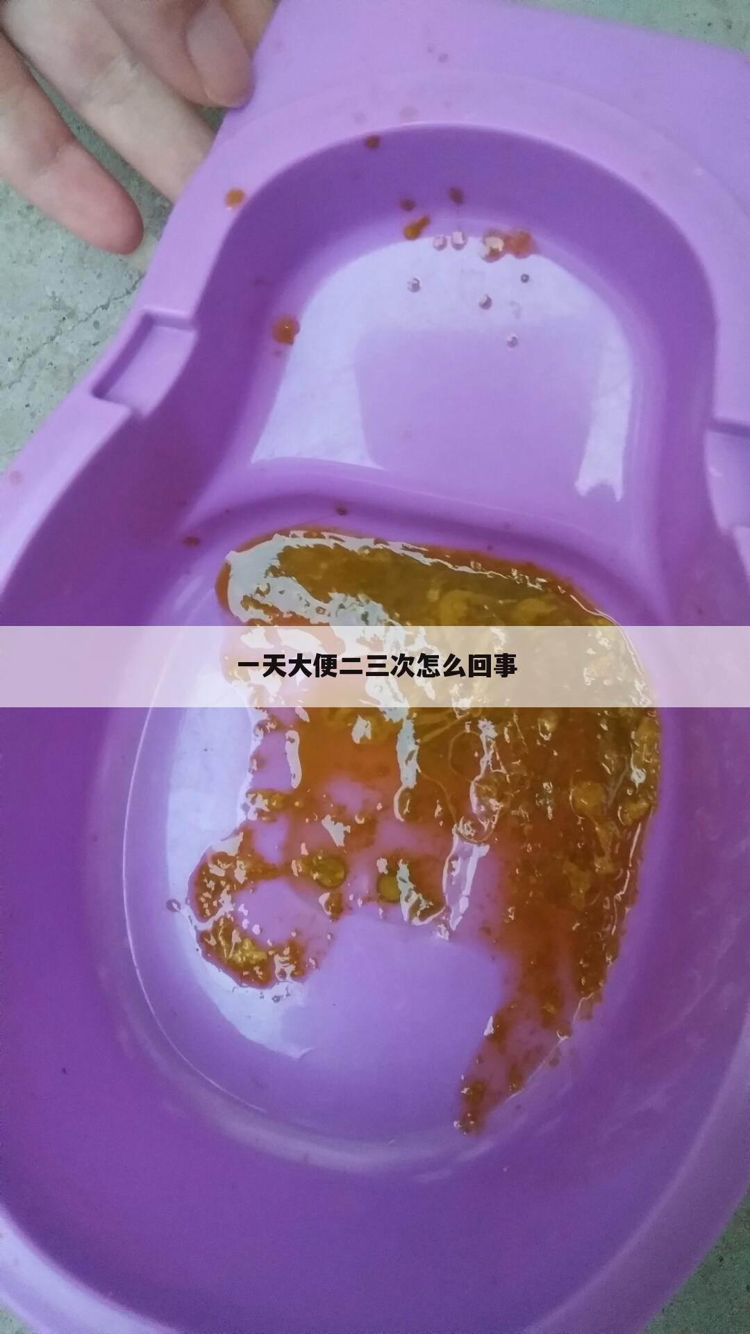 一天大便二三次怎么回事