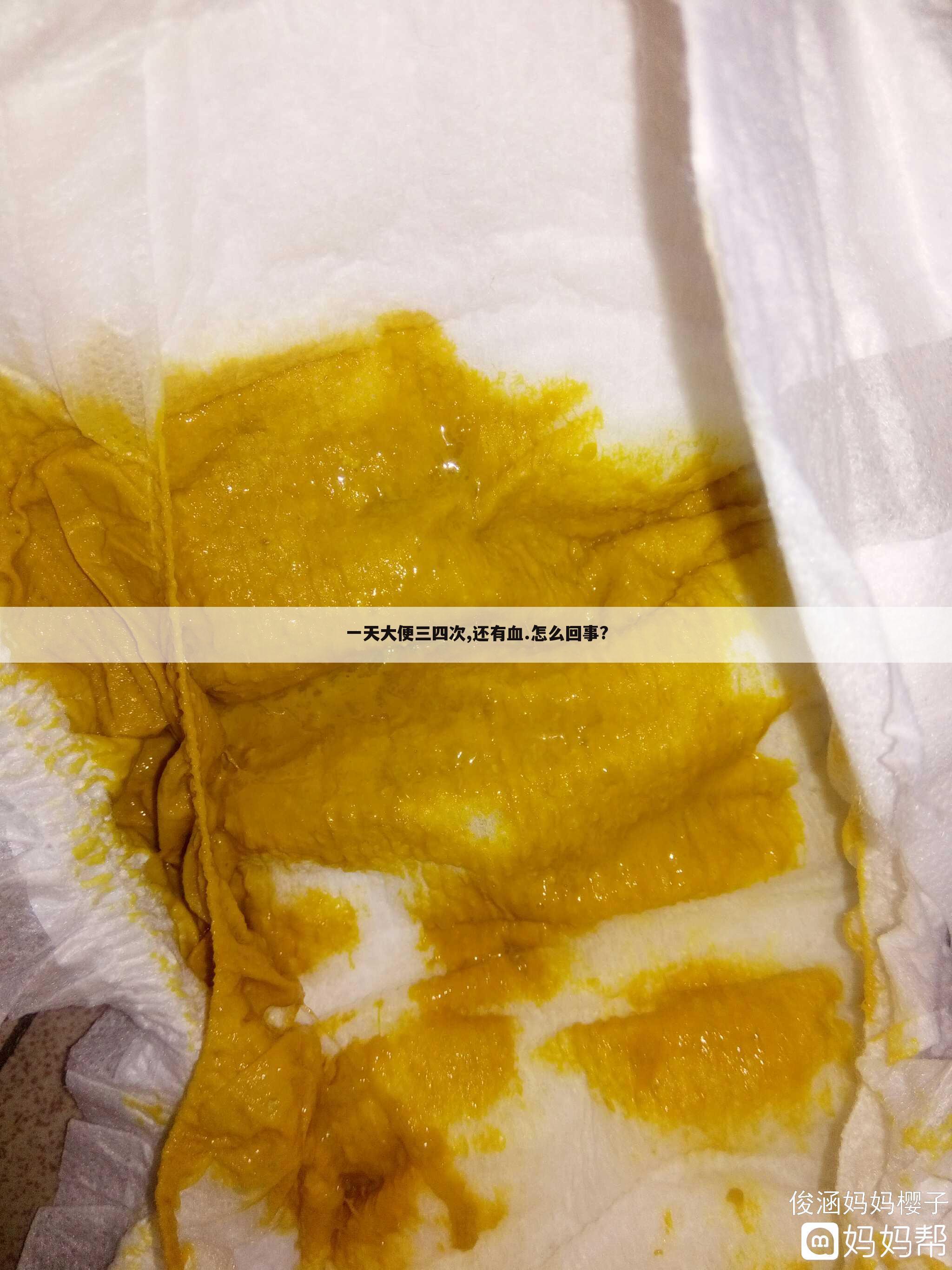 一天大便三四次,还有血.怎么回事?