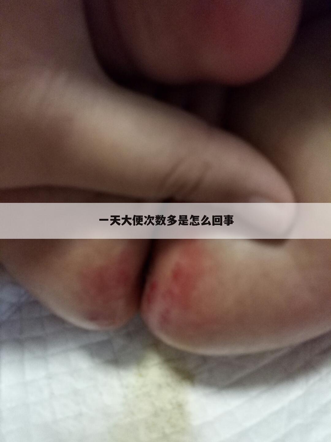 一天大便次数多是怎么回事