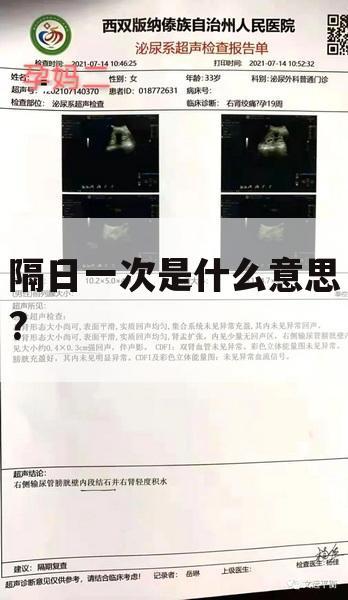 隔日一次是什么意思?