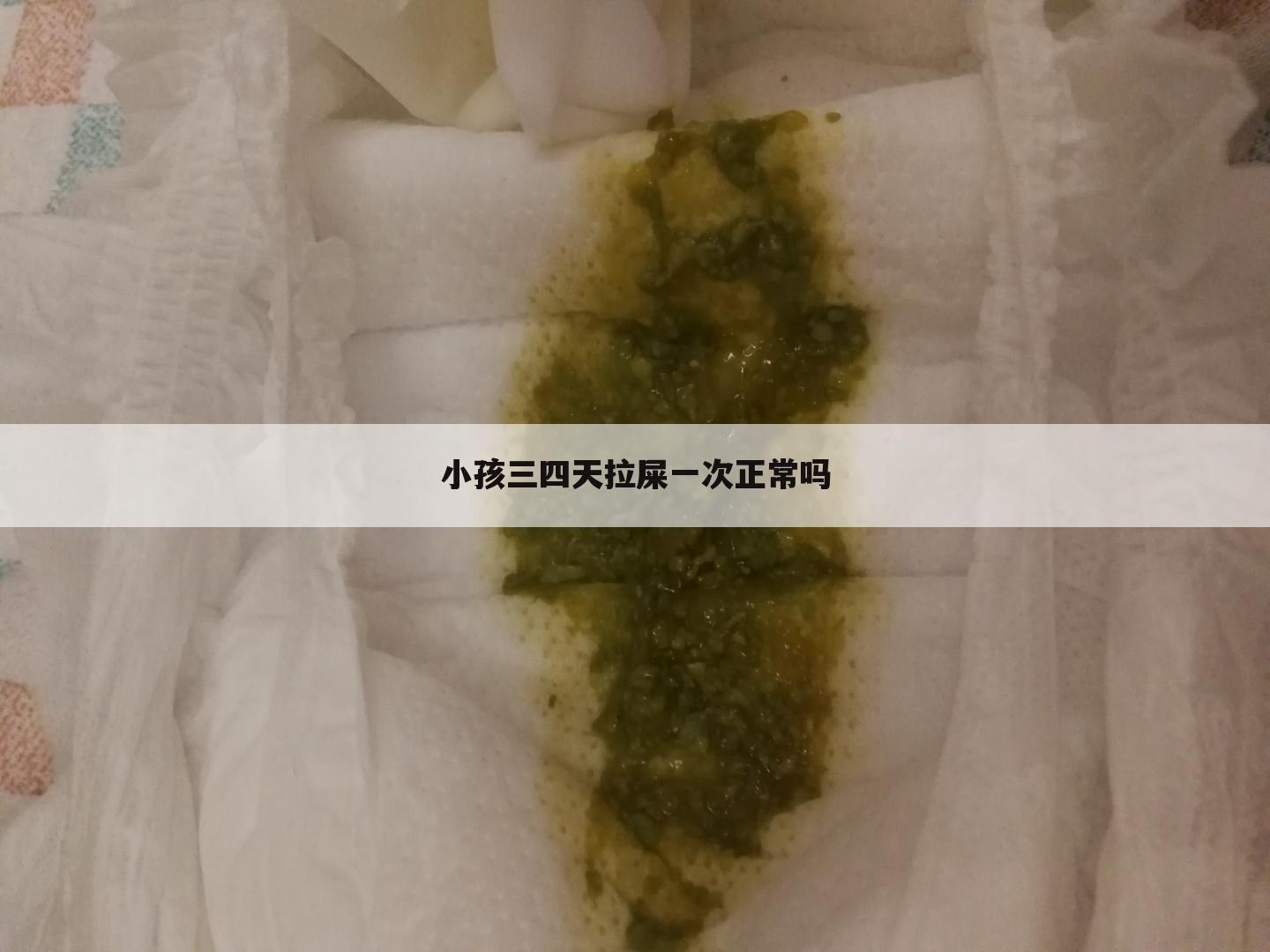 小孩三四天拉屎一次正常吗