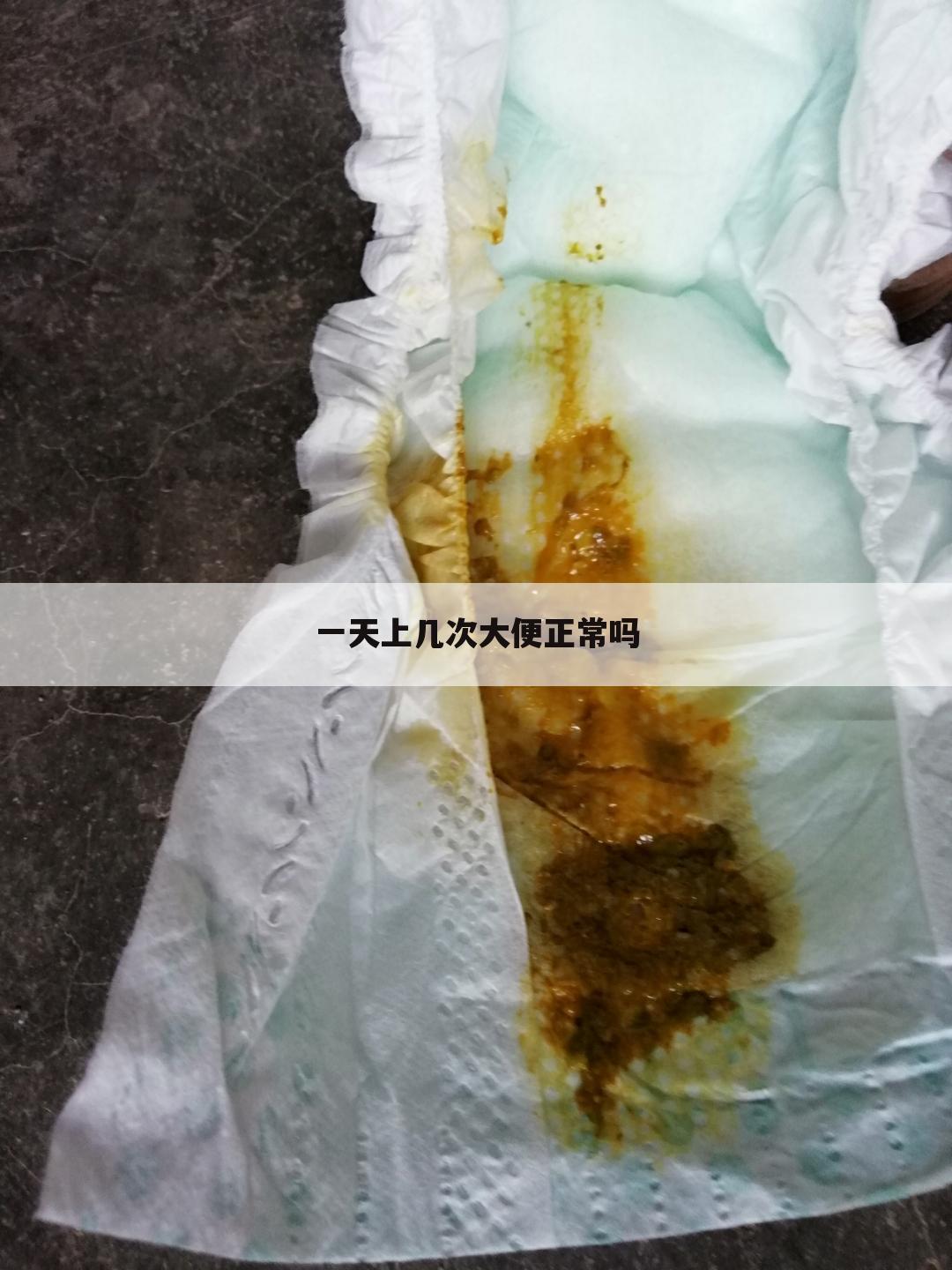 一天上几次大便正常吗