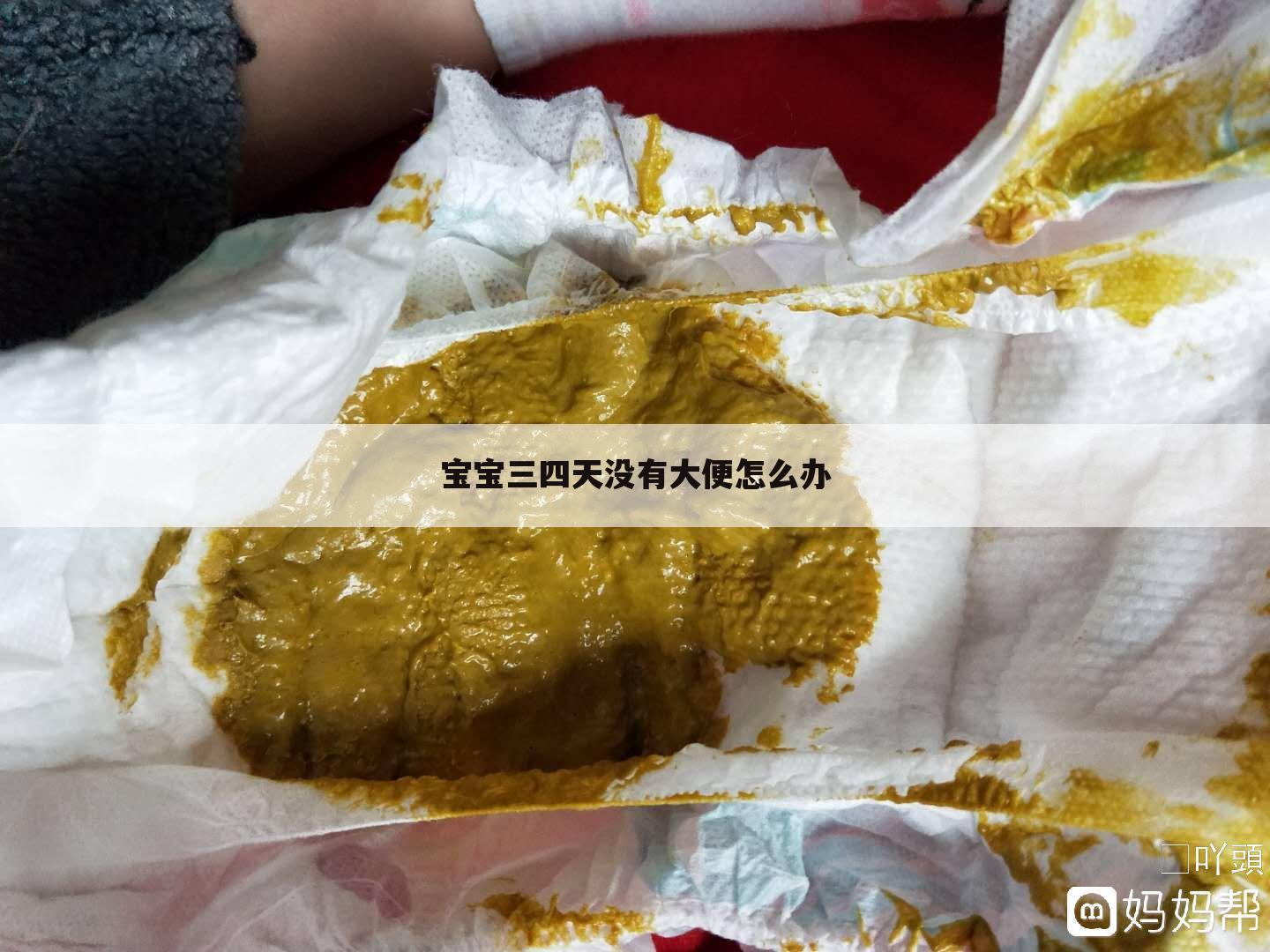 宝宝三四天没有大便怎么办
