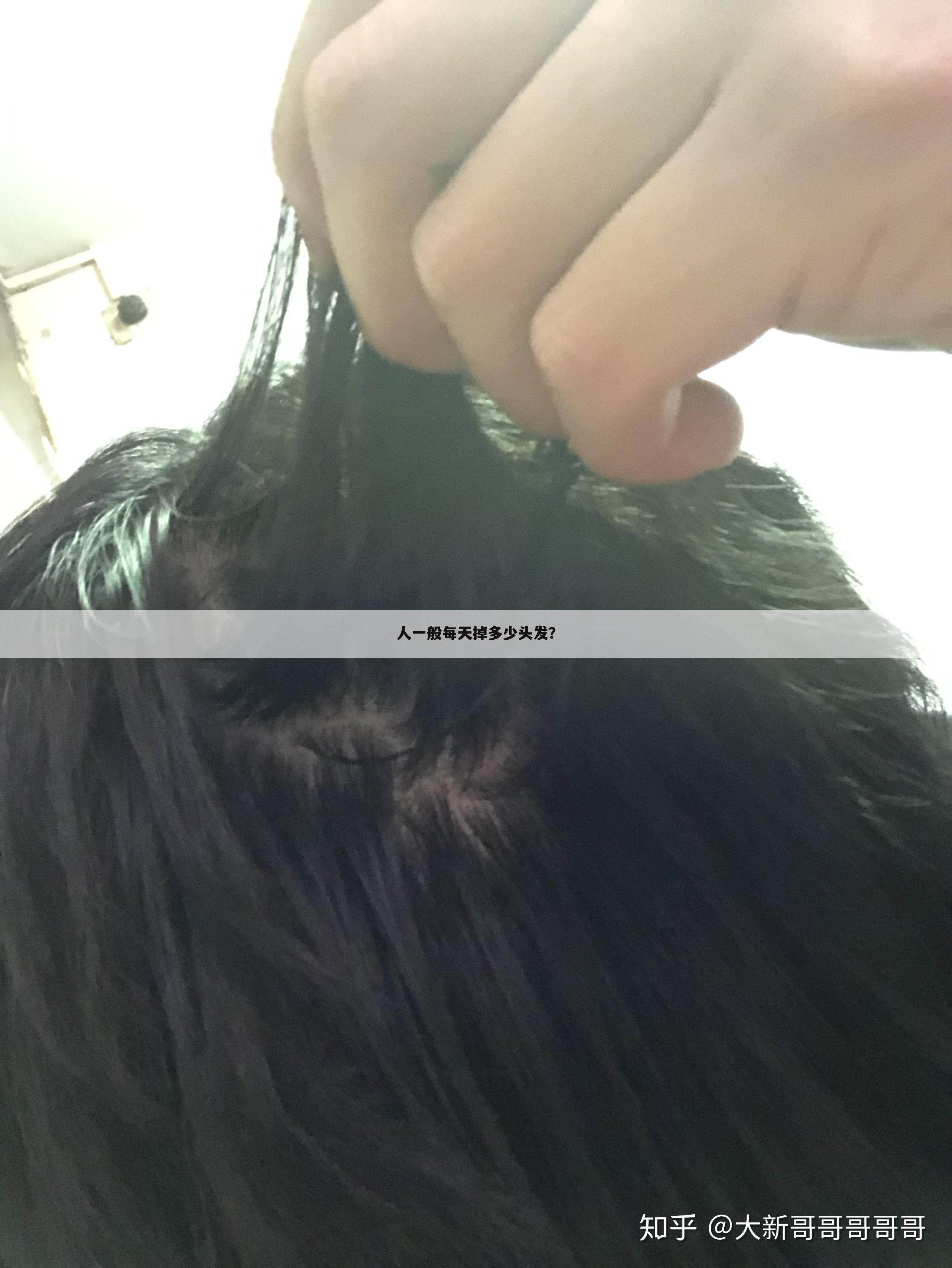 人一般每天掉多少头发？