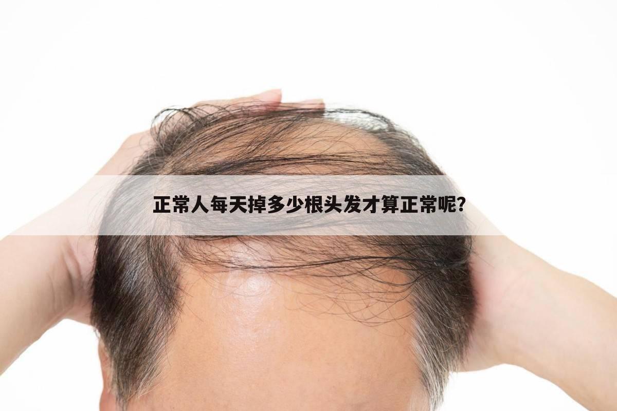 正常人每天掉多少根头发才算正常呢？