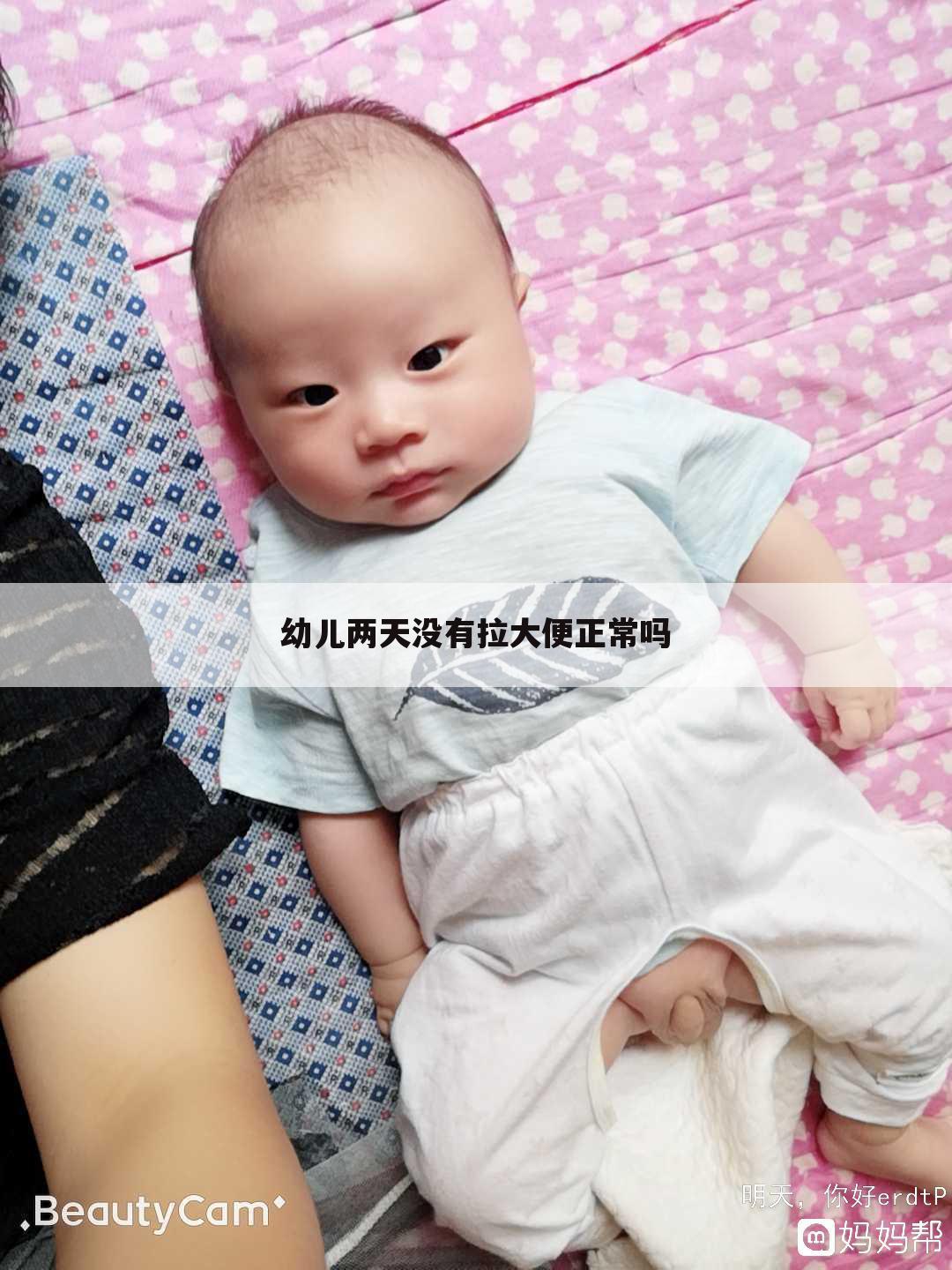 幼儿两天没有拉大便正常吗