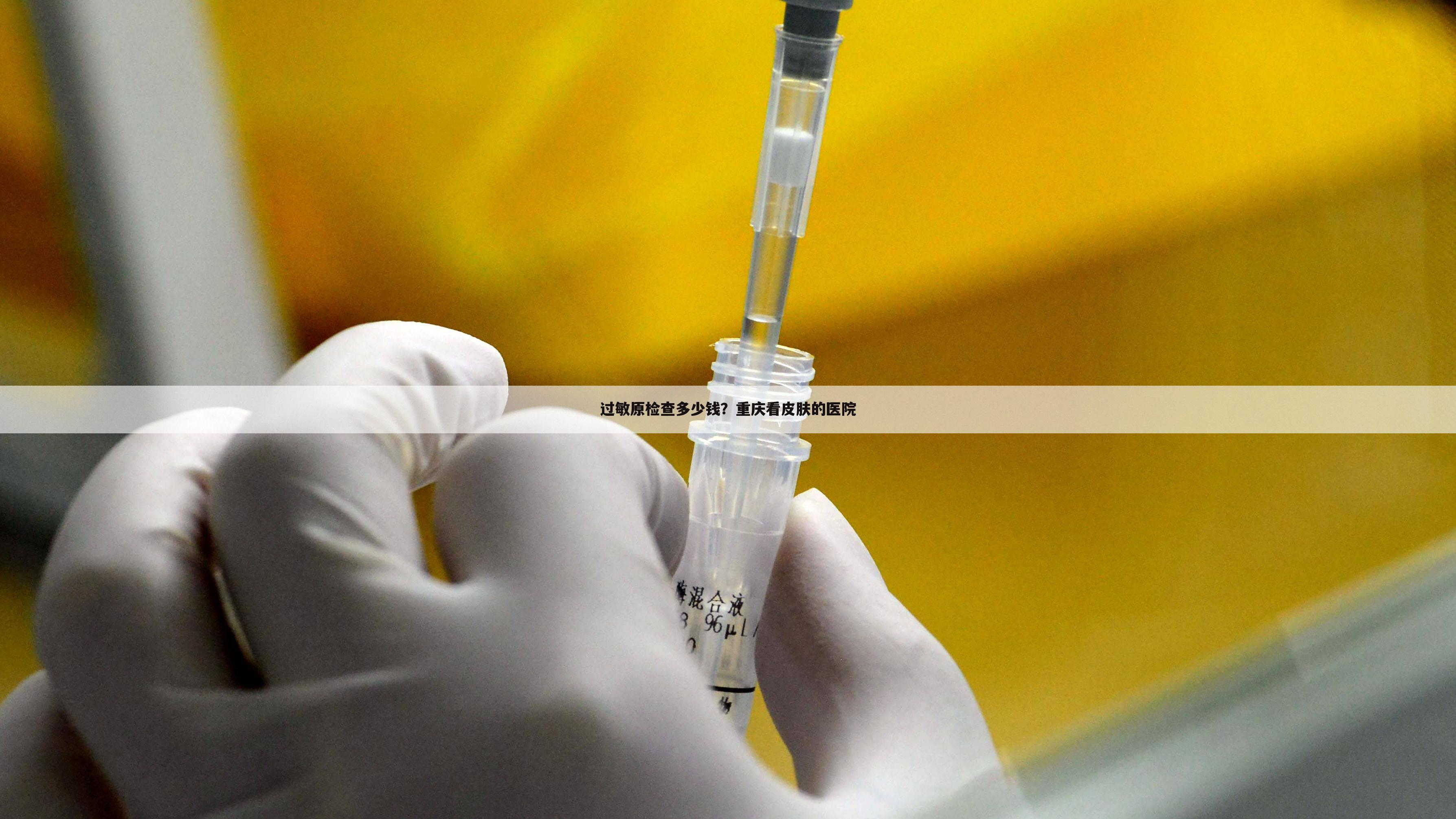 过敏原检查多少钱？重庆看皮肤的医院