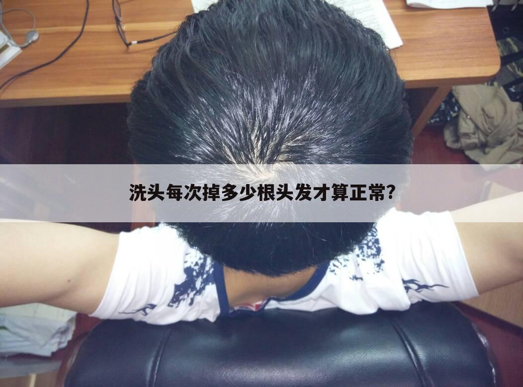 洗头每次掉多少根头发才算正常?