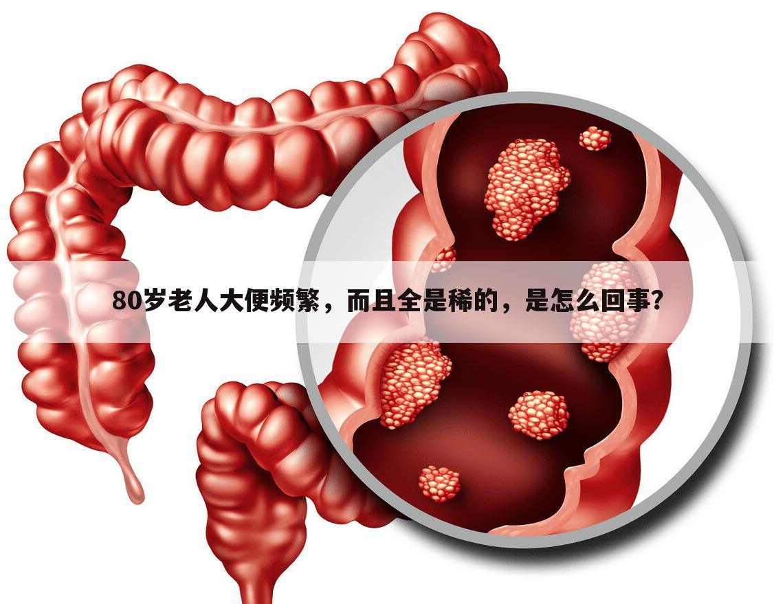 80岁老人大便频繁,而且全是稀的,是怎么回事?