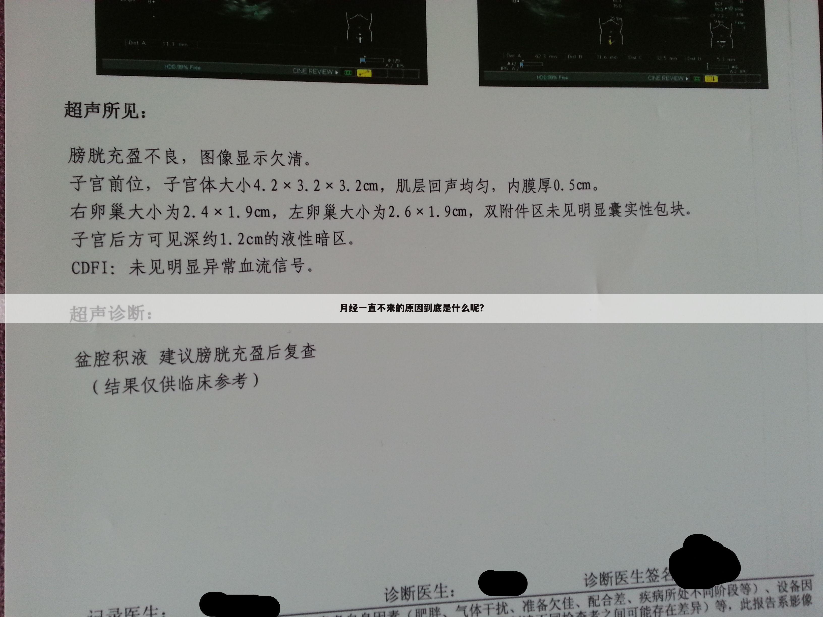 月经一直不来的原因到底是什么呢？